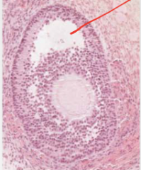 What stage is the following follicle? What epithelium is seen here? What is indicated by the red arrow? Describe what is happening.
 
 
