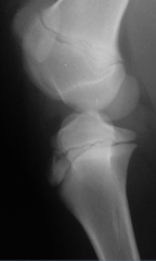 Patella Luxation

developmental problem, dysplasia of femoral trochlea
patella not fixed while standing
overlap, malaligned
laterally positioned, dysplasia of lateral femoral trochlea
