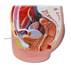 A. ovary
B. urinary bladder
C. vagina
D. uterus