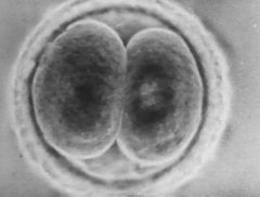 U9 Dev Psych 



The fertilized egg, it enters a 2-week period of rapid cell division and develops into an embryo.