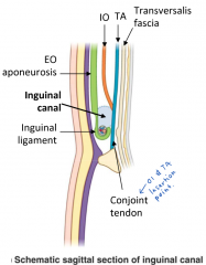 1. Inguinal ligament

2. i) Arch of internal oblique muscle
    ii) Transversus abdominus

3. i) External oblique aponeurosis
    ii) Internal oblique muscle (laterally)

4. i) Transversalis fascia
    ii) Conjoint Tendon (medially)