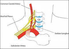 D. C6

FRCA TOTW 256: "The patient is in a supine position with slight extension of the neck. The head is turned to the opposite
side. The needle is introduced between the trachea and the carotid sheath at the level of the cricoid
cartilage and ...