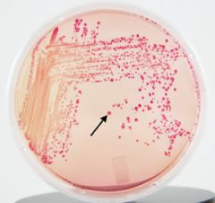The bright pink colonies on this MacConkey plate indicate that ____ is produced when _____ is fermented.