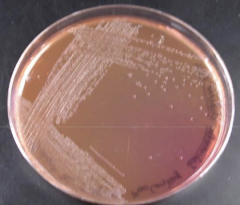 These translucent pale pink colonies on this MAC indicate that ____ was not fermented but ____ was used as a carbon source instead.