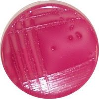 The pink fuzzy halo around these colonies growing on a MacConkey plate is the result of lactose fermentation and the precipitation of ________ because of the very low pH.