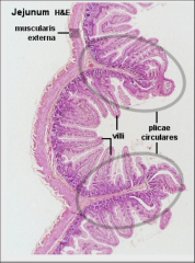 Small intestine (low power)