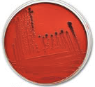 The dark red/maroon colonies on this EMB plate indicate that ____ is produced when _____ is fermented.