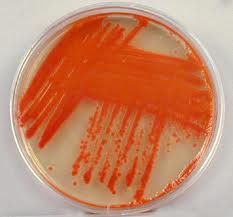 This red pigment indicates that this organism is _____