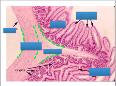Label the four tunics:
Mucosa
Submucosa
Muscularis (with circular and longitudinal muscle layers)
Serosa

And the villi