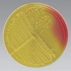The bright colonies with a yellow halo on this MSA plate indicate that ____ is produced when _____ is fermented.