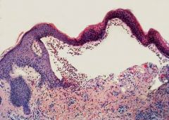 What is this a histologic picture of? How do you know?