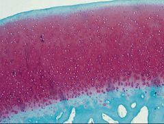 Osteoarthritis is a dynamic process that reflects a balance between ______ and _____. 

What does this image show? What is the pink color staining for?