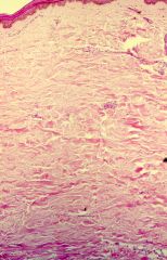 What is seen on this histologic image?