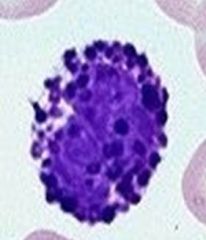 What is this cell? What is contained in the granules?

What conditions could high levels of this be seen in?