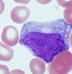 What is the most common condition in young people that presents with increase in this type of cell?

What test is used to confirm?