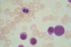 What does the presence of these cells in the circulation indicate?
