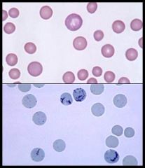 What is the central dot in the cells shown on the bottom (stained with methylene blue)? 

What are these cells an indicator of?
