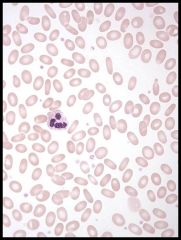 What is poikilocyte? 

What type of cell is seen above?