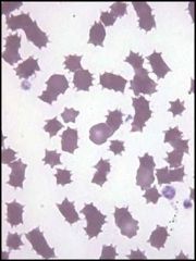 What type of cells are seen here?