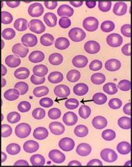 What type of cells are shown here?