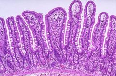 What are the histologic features of normal small intestine?

How do you distinguish different parts of the SI?