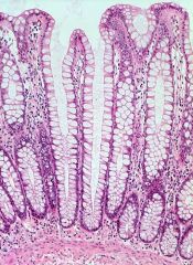 What are the histologic features of normal colon?