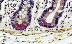 What is the role of the pink cells shown here? Where are they located?

Why do they stain pink?
