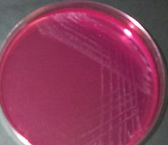These white colonies with a bright pink halo on this MSA indicate that ____ was not fermented but ____ was used as a carbon source instead.