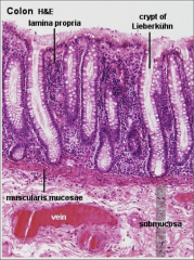 Where is the simple columnar epithelium with many goblet cells?