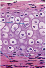 Specialiseret bindevæv - består af ekstracellulær matrix og celler
Indeholder ingen kar (avaskulært), men er omringet af et tæt kollagent bindevæv perikondrium, som indeholder kar og nerver. (Ledbrusk og fibrøs brusk har dog ikke denne)
