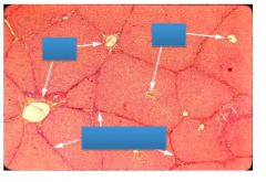 Label the liver lobules with hepatocytes, central vein and portal triad area