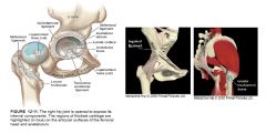 Inguinal ligament=runs from ASIS to pubic tubercle; keeps intestines separate from limb


 


Transverse acetabular ligament=helps connect acetabular notch


 


Ligament of the head of the femur/ligamentum teres=runs from acetabulum to fovea ca...