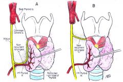 inferior thyroid artery