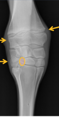 angular limb deformity
-used to define level of maximum deviation
. irregular physis
. wedge shaped epiphysis
. delayed development lateral styloid process
. cuboidal bone disease