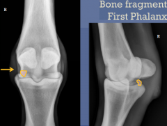 osteochondrosis

bone fragment proximal phalanx