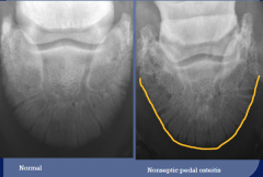 pedal osteitis complex

poorly defined complex that refers to nonspecific inflammation of P3
poor correlation to lameness
changes may be permanent

radiographic findings:
-modelling changes of the solar margin
-discrete circular lucent reg...