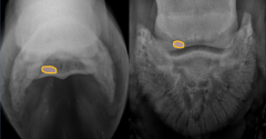 Navicular degeneration

navicular skyline and 60 degree DP view

changes in synovial invaginations

avulsions, smooth margin, overlying medullary cavity of navicular bone