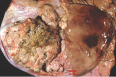 Neoplasia arising from Aglandular portion of stomach in horse.