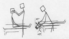 Uses the Dix-Hallpike positioning maneuver to test the vestibular division of CN8. The pt is quickly moved from a sitting position to a supine one w/ the head below 45deg. and turned to one side. (repeat for other side) if the pt reports vertigo d...