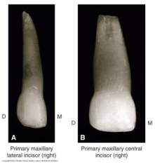 -Crowns are longer incisocervically than mesiodistally


-Max central incisor is wider mesiodistally