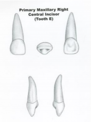 - Facial cervical ridge


- Bulbous cingulum


-Squat crown characteristic of primary anterior teeth