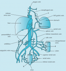 Portal vein ➙ Paraumbilical vein ➙ Superficial epigastric veins ➙ External iliac vein ➙ Common iliac vein ➙ IVC