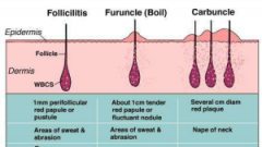 Folliculitis, Boils (furuncles) and carbuncles (mass of furuncles)