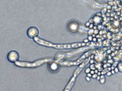 * Most common yeast
* Produces thick wall chlamydospores