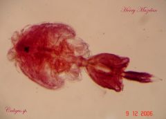 In Phylum Arthropoda, Subphylum CrustaceaDiverse