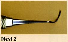 Paired, mirror-image working-ends
Thin, curved sickle for use on posterior teeth
Long cutting edge facilitates access to proximal tooth surfaces
Use on coronal surfaces of posterior teeth