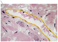 What term is used to refer to the highlighted epithelium in a blood vessel?