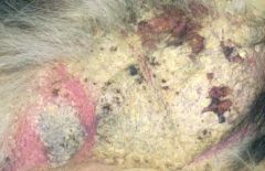 primary or secondary lesions 
crust is formed from dried exudate which sticks to the skins surface. ( serum/blood/cells/scale) eg from erosions /ulcers/pustules