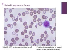 Caption:

This peripheral blood smear demonstrates marked poikilocytosis (abnormally shaped RBC's) as well as some anisocytosis (variation in RBC size), though many are small (microcytes). This patient had beta-thalassemia, a hereditary disorder ...