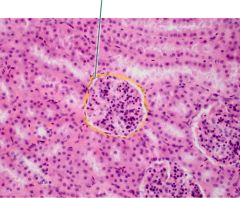 which epithelial type is this?